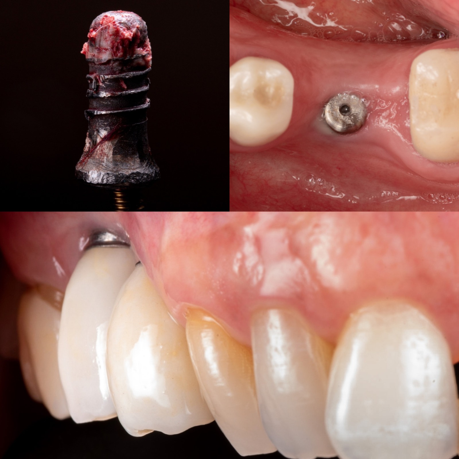 Clinicians at a hands-on implant complications lab