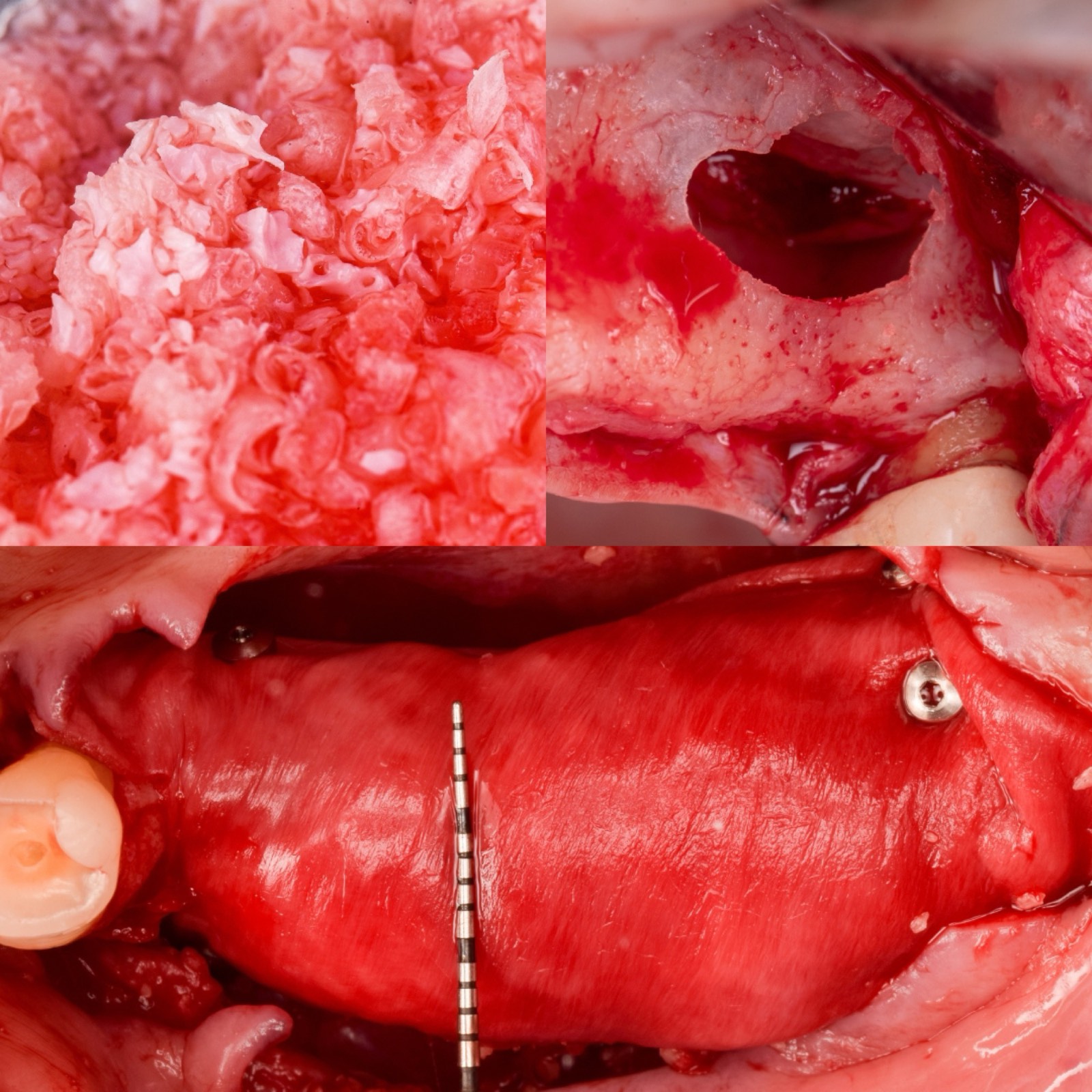Clinicians at a hands-on bone grafting and sinus lab